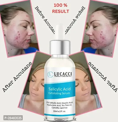 LUCACCI Brightening  Whitening Vitamin C Face Serum, hyaluronic acid for Anti pimple, Acne Free Skin, Aloe Vera extract for face Anti Ageing, Face Oil  Serum for Dry Skin and Oily Skin, Fairness  Face Glow | 30ml *1