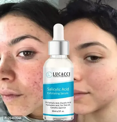 LUCACCI Brightening  Whitening Vitamin C Face Serum, hyaluronic acid for Anti pimple, Acne Free Skin, Aloe Vera extract for face Anti Ageing, Face Oil  Serum for Dry Skin and Oily Skin, Fairness  Face Glow | 30ml *1