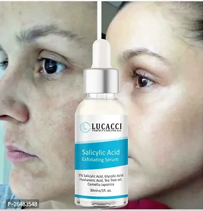 LUCACCI Brightening  Whitening Vitamin C Face Serum, hyaluronic acid for Anti pimple, Acne Free Skin, Aloe Vera extract for face Anti Ageing, Face Oil  Serum for Dry Skin and Oily Skin, Fairness  Face Glow | 30ml *1