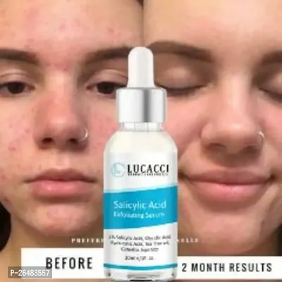 LUCACCI Brightening  Whitening Vitamin C Face Serum, hyaluronic acid for Anti pimple, Acne Free Skin, Aloe Vera extract for face Anti Ageing, Face Oil  Serum for Dry Skin and Oily Skin, Fairness  Face Glow | 30ml *1