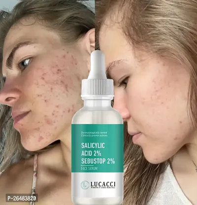 LUCACCI Brightening  Whitening Vitamin C Face Serum, hyaluronic acid for Anti pimple, Acne Free Skin, Aloe Vera extract for face Anti Ageing, Face Oil  Serum for Dry Skin and Oily Skin, Fairness  Face Glow | 30ml *1