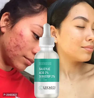 LUCACCI Brightening  Whitening Vitamin C Face Serum, hyaluronic acid for Anti pimple, Acne Free Skin, Aloe Vera extract for face Anti Ageing, Face Oil  Serum for Dry Skin and Oily Skin, Fairness  Face Glow | 30ml *1