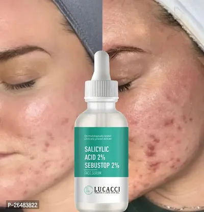 LUCACCI Brightening  Whitening Vitamin C Face Serum, hyaluronic acid for Anti pimple, Acne Free Skin, Aloe Vera extract for face Anti Ageing, Face Oil  Serum for Dry Skin and Oily Skin, Fairness  Face Glow | 30ml *1