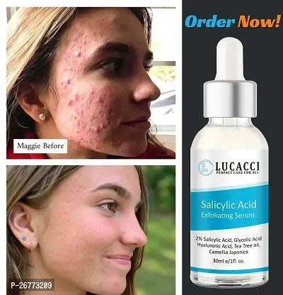 LUCACCI Brightening  Whitening Vitamin C Face Serum, hyaluronic acid for Anti pimple, Acne Free Skin, Aloe Vera extract for face Anti Ageing, Face Oil  Serum for Dry Skin and Oily Skin, Fairness  Face Glow | 30ml *1