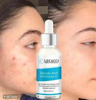 LUCACCI Brightening  Whitening Vitamin C Face Serum, hyaluronic acid for Anti pimple, Acne Free Skin, Aloe Vera extract for face Anti Ageing, Face Oil  Serum for Dry Skin and Oily Skin, Fairness  Face Glow | 30ml *1-thumb0