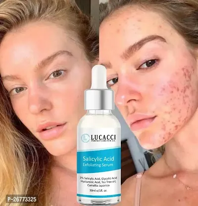 LUCACCI Brightening  Whitening Vitamin C Face Serum, hyaluronic acid for Anti pimple, Acne Free Skin, Aloe Vera extract for face Anti Ageing, Face Oil  Serum for Dry Skin and Oily Skin, Fairness  Face Glow | 30ml *1-thumb0