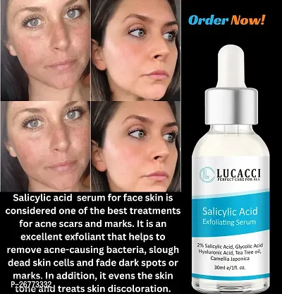 LUCACCI Brightening  Whitening Vitamin C Face Serum, hyaluronic acid for Anti pimple, Acne Free Skin, Aloe Vera extract for face Anti Ageing, Face Oil  Serum for Dry Skin and Oily Skin, Fairness  Face Glow | 30ml *1