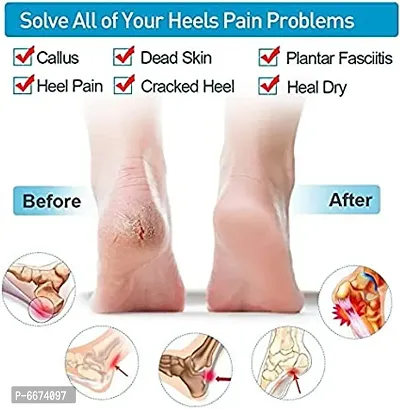 Anti crack heel for men and women,Silic-1Pair-thumb4