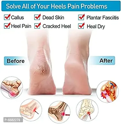 Anti crack heel for men and women,Silic-2 Pair-thumb5