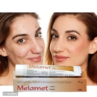 MELAMET SCAR REMOVER  ACNE CARE SKIN CREAM 15 Gm (PACK OF 1)Dark Spot And Pimple Removing Cream .-thumb0