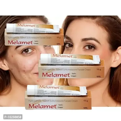 MELAMET SCAR REMOVER  ACNE CARE SKIN CREAM 15 Gm (PACK OF 3)Dark Spot And Pimple Removing Cream .-thumb0