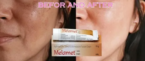 Melamet Cream Skin Whitening Cream Day  Night Cream 15gm (Pack of 10)-thumb3