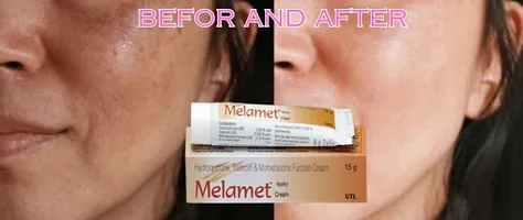 Melamet Fairness Cream Also Reduces Scars, Marks, Day  Night Cream And Dark Circles (15gm Each) (Pack Of 4)-thumb3