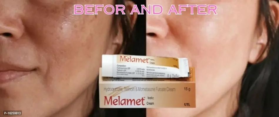 Melamet whitening cream For Men  Women Night Used (Pack Of 7)-thumb4