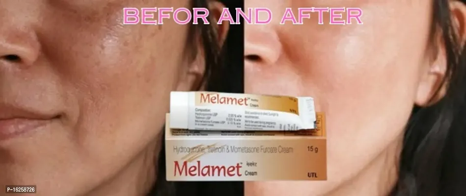 Melamet Cream Skin Whitening Cream Day  Night Cream 15gm (Pack of 2)-thumb3