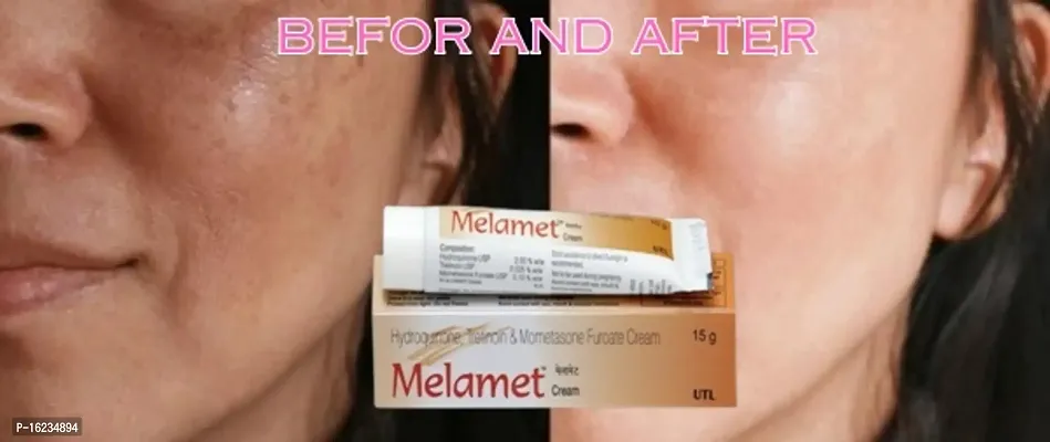 melamet face cream 15g Dark Spot And Pimple Removing Pack of 7-thumb2