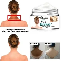 Neck Cream for Acanthosis Nigricans | For Dark Body Parts Like Neck, Ankles, Knuckles, Armpits, Thighs, Elbows| Exfoliant-thumb2