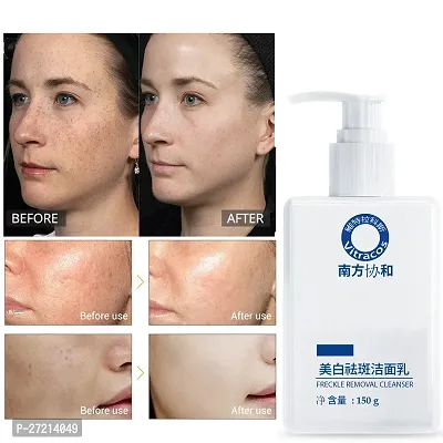 freckle removal Cleanser - Plant Compound brightening Facial Cleanser Glowing  Refreshing skin Face Wash-thumb5