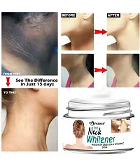 Neck Cream for Acanthosis Nigricans | For Dark Body Parts Like Neck, Ankles, Knuckles, Armpits, Thighs, Elbows| Exfoliant-thumb2