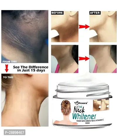 Neck Cream for Acanthosis Nigricans | For Dark Body Parts Like Neck, Ankles, Knuckles, Armpits, Thighs, Elbows| Exfoliant-thumb3