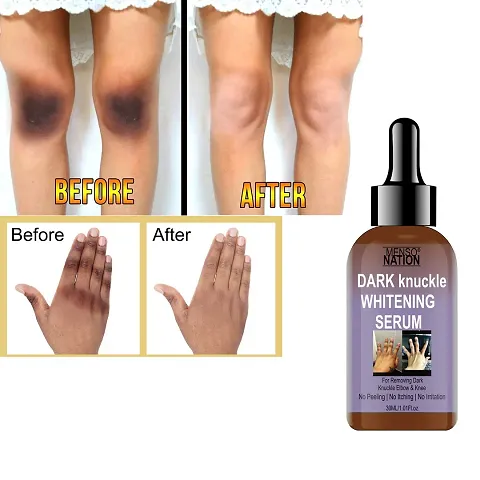 MENSONATION Whitening Serum