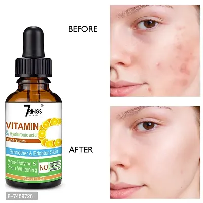 7Rings Vitamin C Face Serum With 20% Vitamin C For Skin Brightening And Whitening -30 Ml-thumb0