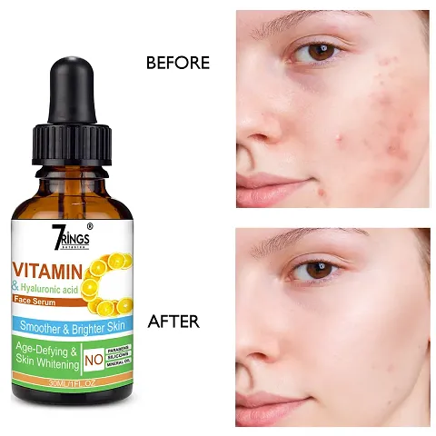 7RINGS Vitamin C Face Serum For Skin Brightening And Whitening