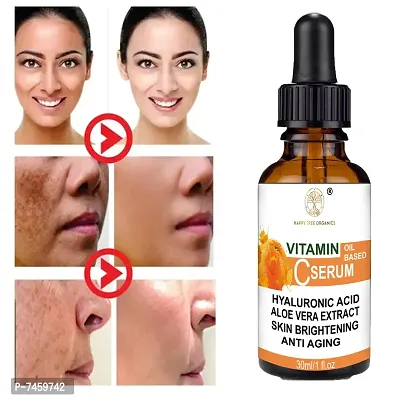 Mensonation Vitamin C Face Serum With 20% Vitamin C For Skin Brightening And Whitening -30 Ml-thumb0