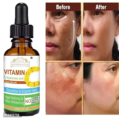 Happytree Organics Vitamin C Face Serum With 20% Vitamin C For Skin Brightening And Whitening -30 Ml-thumb0