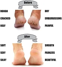 Silicone Socks For Crack Heels | Anti Crack Heel Moisturising Socks | Full Length |-thumb3