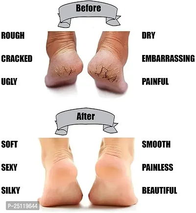 Silicone Socks For Crack Heels | Anti Crack Heel Moisturising Socks | Full Length |-thumb4