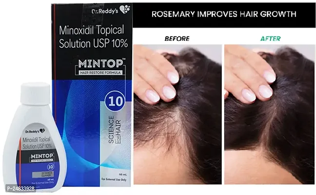 _MINTOP HAIR SOLUTION USP 10%