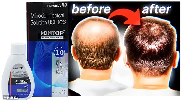 __MINTOP HAIR SOLUTION USP 10%