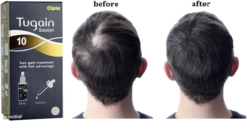 ''NEW TUGAIN 10 HAIR GAIN SOLUTION-thumb0