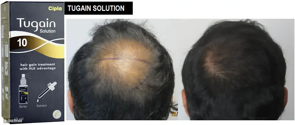 ;NEW TUGAIN 10 HAIR GAIN SOLUTION-thumb0