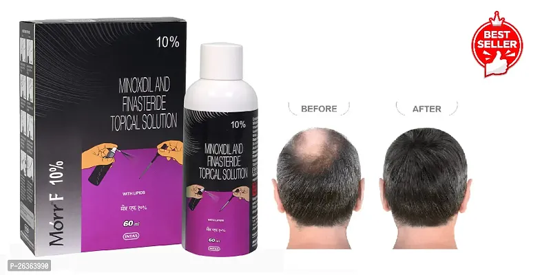 minoxidil morr F10% pack of 1....-thumb0