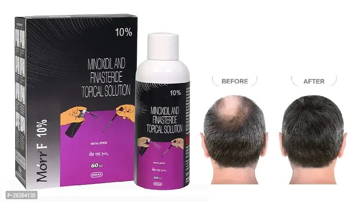 minoxidil morr F10% pack of 1.....-thumb0