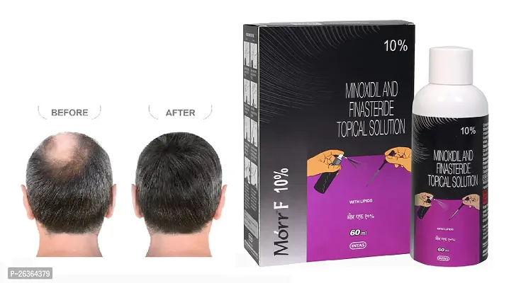 minoxidil morr F10% pack of 1,-thumb0