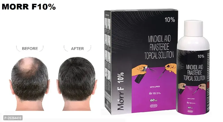 minoxidil morr F10% pack of 1,,,-thumb0