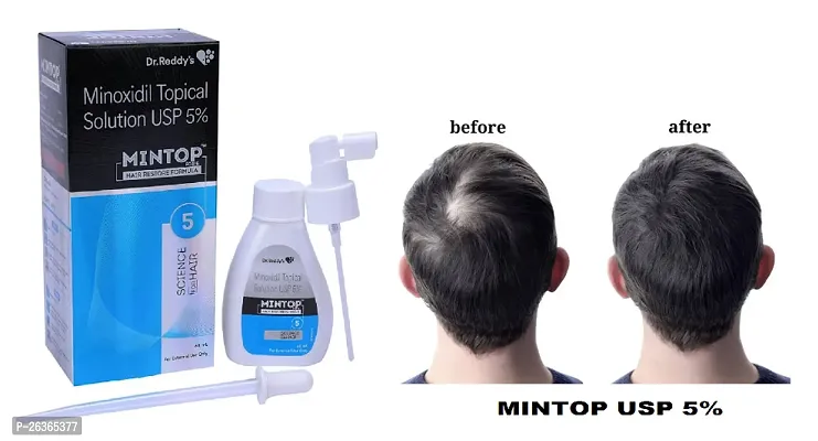 minoxidil mintop 5 pack of 1,-thumb0