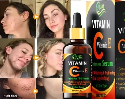Quat Vitamin C 25% And E 8%Face Serum For Instant Whitening And Brightening Skin-30 Ml