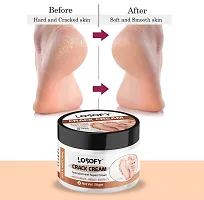 LOSOFY Crack cream Specialist Heel Repair Cream 50 gm-thumb2