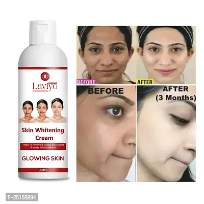 Skin Whitening Cream Acne Care Face Cream, Face Cream For Oily Skin, Face Cream For Men and women 50 gm-thumb0