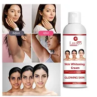 Skin Whitening Cream Acne Care Face Cream, Face Cream For Oily Skin, Face Cream For Men and women 50 gm-thumb2