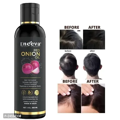Eneeva Onion Hair Oil for Men  Women with Onion  Redensyl for Hair Fall Control, Hair Growth Oil for Hair Fall - 100ml-thumb0