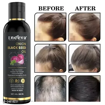 ENEEVA Organic Blackseed Oil Cold Pressed | Certified Organic Cold Pressed Kalonji Oil for Hair Growth, Drink and Skin care | Immunity Booster | Edible Grade | 100ml