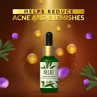 NEUD Xpose Yourself Rapid Clearance Acne Treatment Serum With Salicylic Acid, Bakuchiol and Niacinamide (30 ml)-thumb3