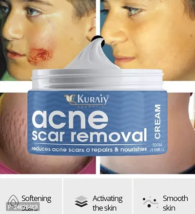 KURAIY Acne Face Cream Herbal Pimple Scar Removal Shrink Pore Oil Control Moisturizing Facial Cream Acne-thumb0