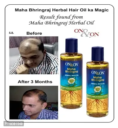 ON AND ON ... HAIR REGROWTH HAIR OIL 200ML FOR MAN\WOMEN PACK OF 2