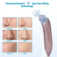 4 in 1 Rechargeable Device ! Multi-function Blackhead Remover and Whitehead Remover Device - Acne Pore Cleaner Vacuum Suction Tool for Men and Women Gently pull dirt and oil out of your skin facial-thumb1